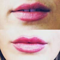 before and after applying lip volumizer